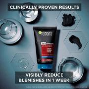 Garnier Pure Active Intensive 3 in 1 Anti-Blackhead Charcoal Wash, Scr...